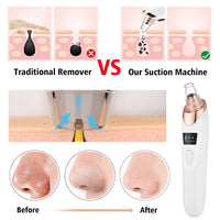 Electric Blackhead Remover